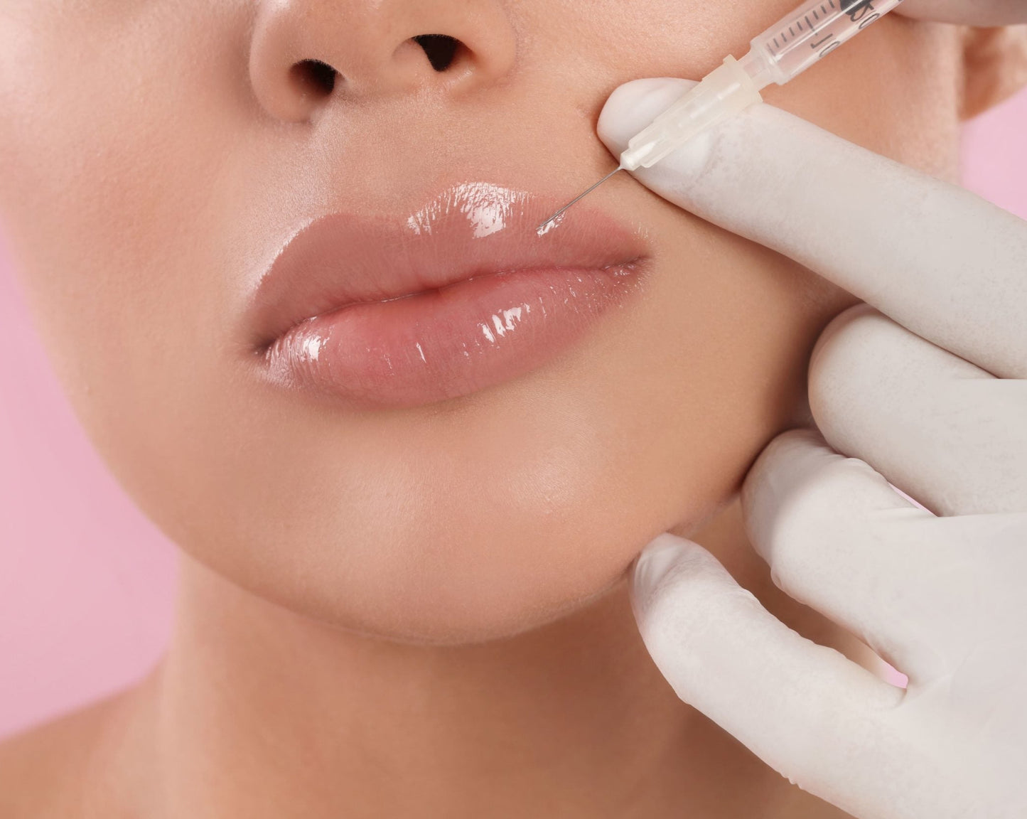 Fillers